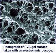 Photograph of PVA-gel surface taken with an electron microscope